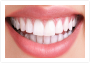 Teeth Whitening After at Port Orchard Dental Care